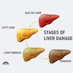 Green World Liver Wellness Support Supplement Package – Green World Health Kenya